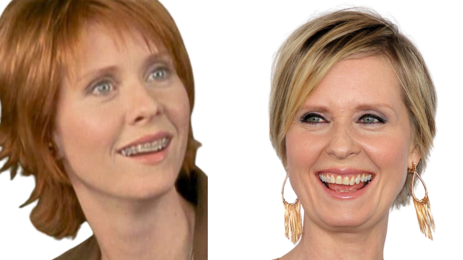 cynthia-nixon-teeth before and after 