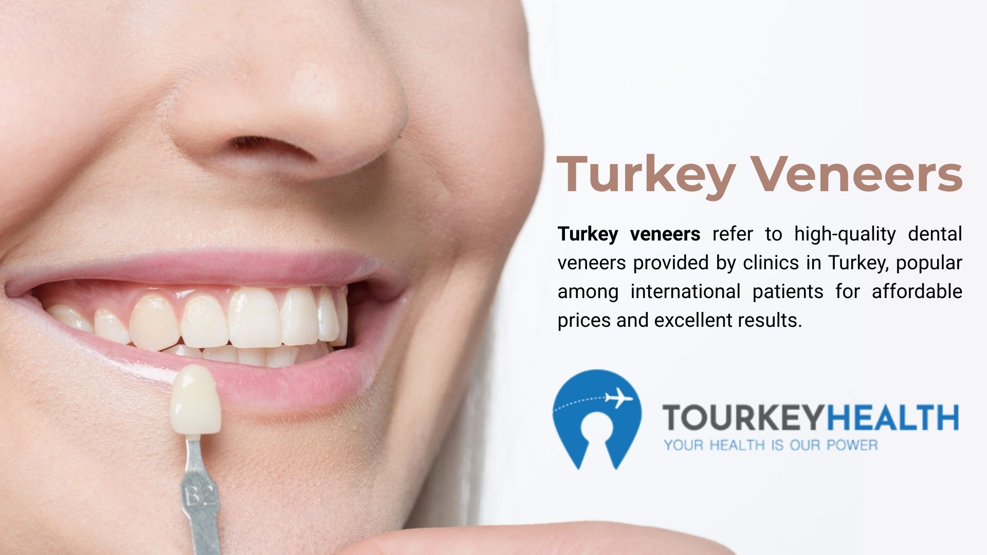 turkey-veneers